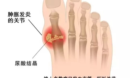 食物破壁后会破坏营养吗-破壁的食物有营养吗网 :分享破壁是什么功能-破壁是干嘛的知识